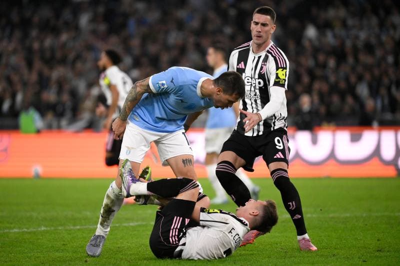 Football. Serie A. SS Lazio - Juventus FC. 26.10.2025