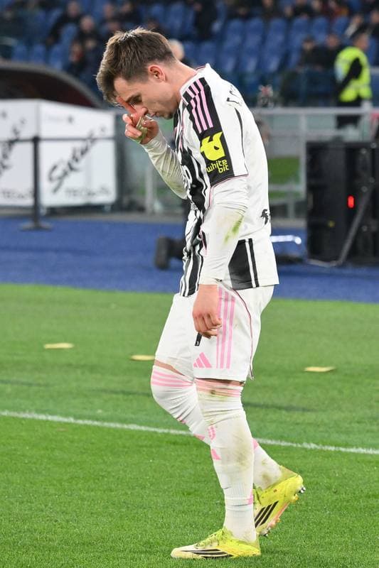 Football. Serie A. AS Roma - Juventus. 01.03.2026