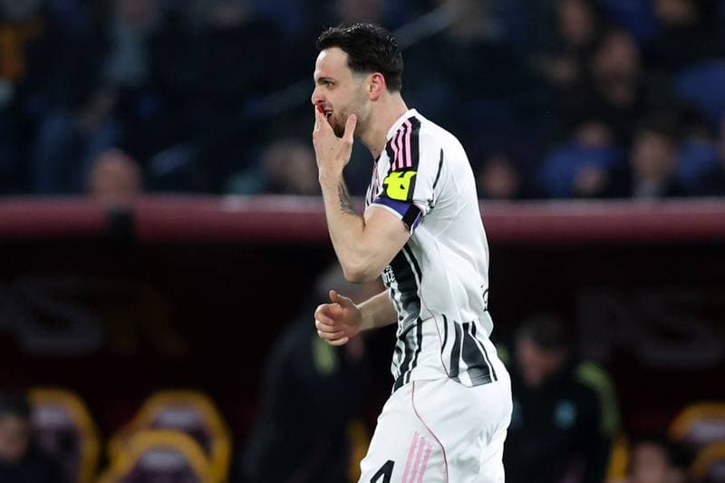 Football. Serie A. AS Roma - Juventus. 01.03.2026