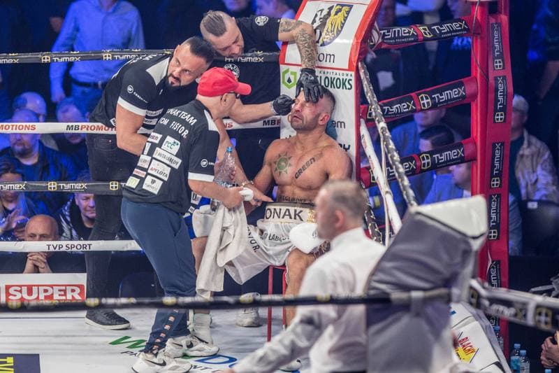 Boxing. Tymex Boxing Night 21. Slaskie Uderzenie. 22.04.2022