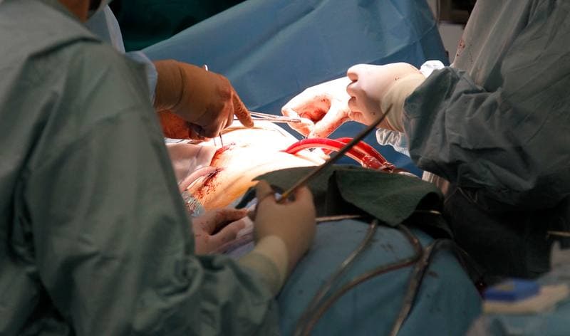 Cardiac Surgery. Religa Heart Foundation. Press Conference. 14.10.2015
