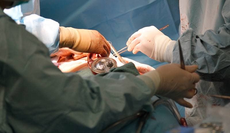 Heart Surgery. Katowice. 14.10.2015