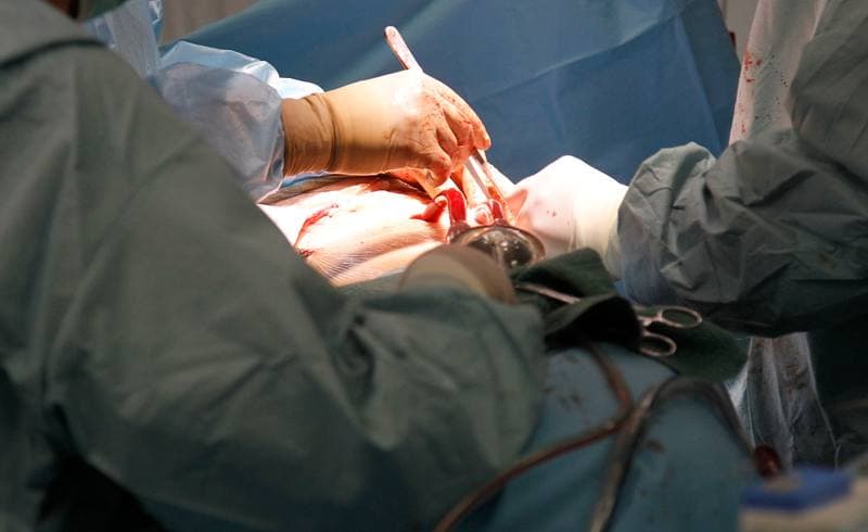 Heart Surgery. Katowice. 14.10.2015